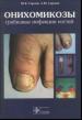 Сергеев Ю.В.,  Сергеев А.Ю. - Oнихомикозы - грибковые инфекции ногтей